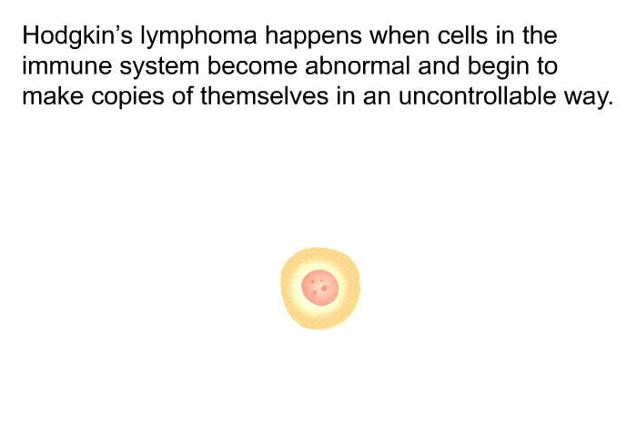 Hodgkin's lymphoma happens when cells in the immune system become abnormal and begin to make copies of themselves in an uncontrollable way.