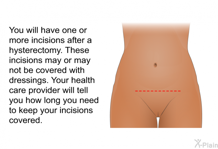 You will have one or more incisions after a hysterectomy. These incisions may or may not be covered with dressings. Your health care provider will tell you how long you need to keep your incisions covered.