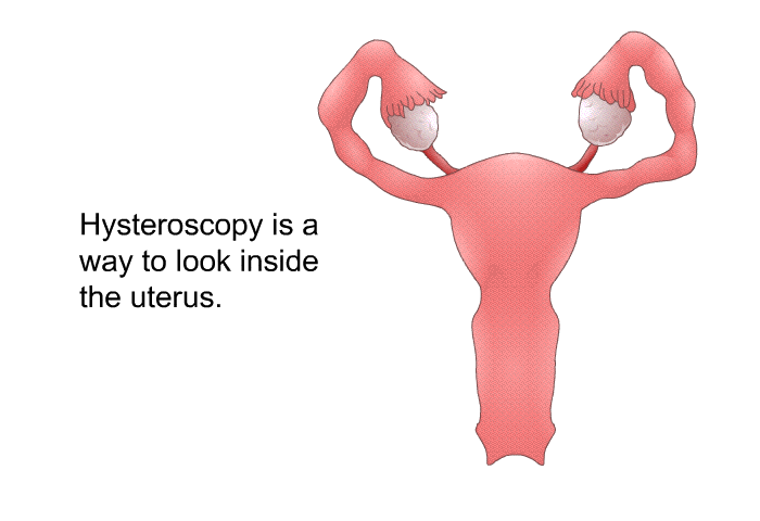 Hysteroscopy is a way to look inside the uterus.