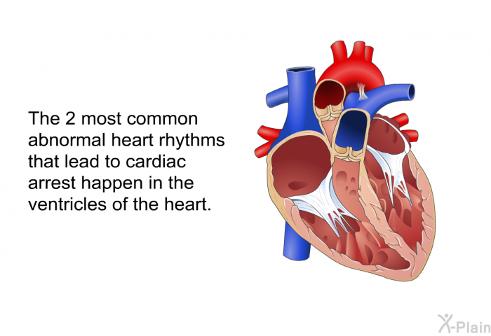 The 2 most common abnormal heart rhythms that lead to cardiac arrest happen in the ventricles of the heart.