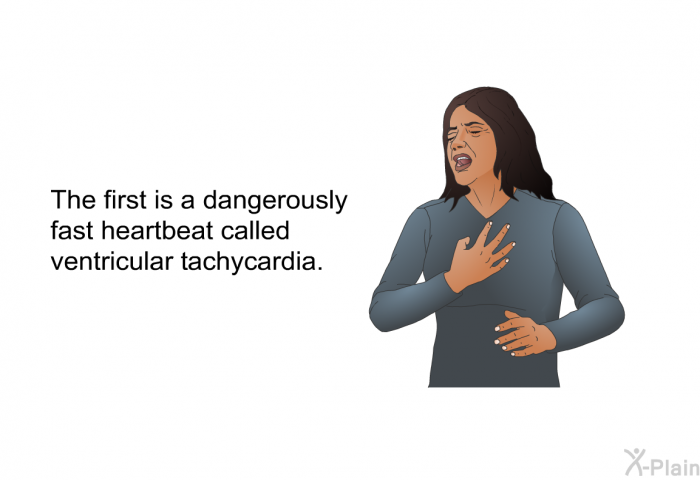 The first is a dangerously fast heartbeat called ventricular tachycardia.