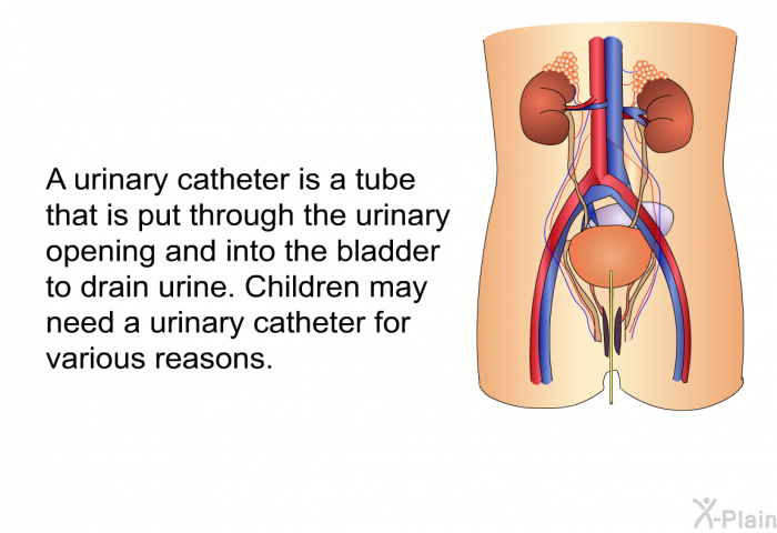 A urinary catheter is a tube that is put through the urinary opening and into the bladder to drain urine. Children may need a urinary catheter for various reasons.