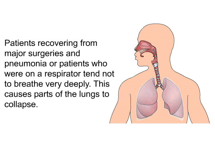 Patients recovering from major surgeries and pneumonia or patients who were on a respirator tend not to breathe very deeply. This causes parts of the lungs to collapse.