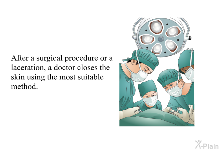 After a surgical procedure or a laceration, a doctor closes the skin using the most suitable method.