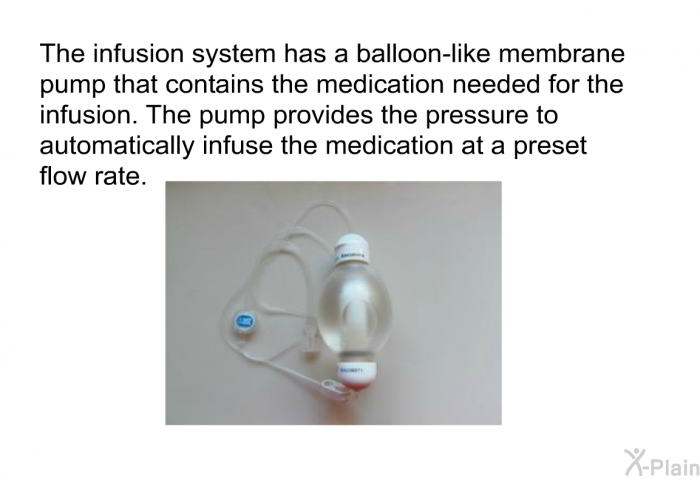 The infusion system has a balloon-like membrane pump that contains the medication needed for the infusion. The pump provides the pressure to automatically infuse the medication at a preset flow rate.