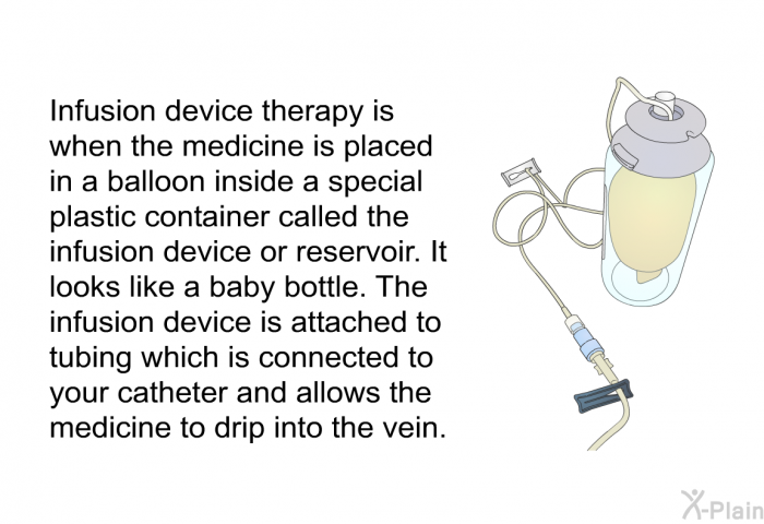 Infusion device therapy is when the medicine is placed in a balloon inside a special plastic container called the infusion device or reservoir. It looks like a baby bottle. The infusion device is attached to tubing which is connected to your catheter and allows the medicine to drip into the vein.