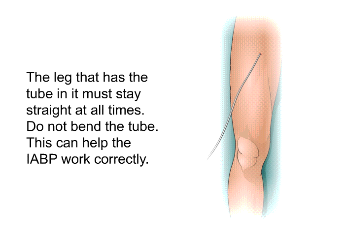The leg that has the tube in it must stay straight at all times. Do not bend the tube. This can help the IABP work correctly.