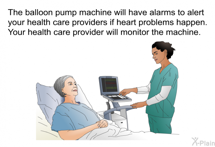 The balloon pump machine will have alarms to alert your health care providers if heart problems happen. Your health care provider will monitor the machine.