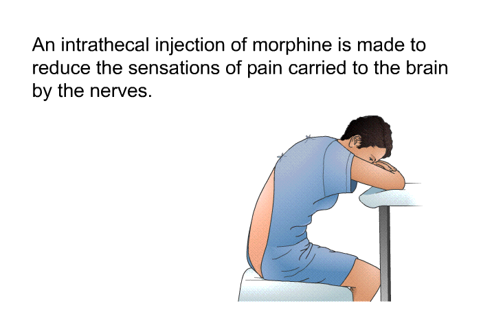 An intrathecal injection of morphine is made to reduce the sensations of pain carried to the brain by the nerves.