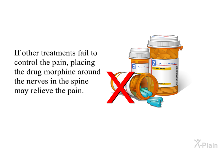 If other treatments fail to control the pain, placing the drug morphine around the nerves in the spine may relieve the pain.