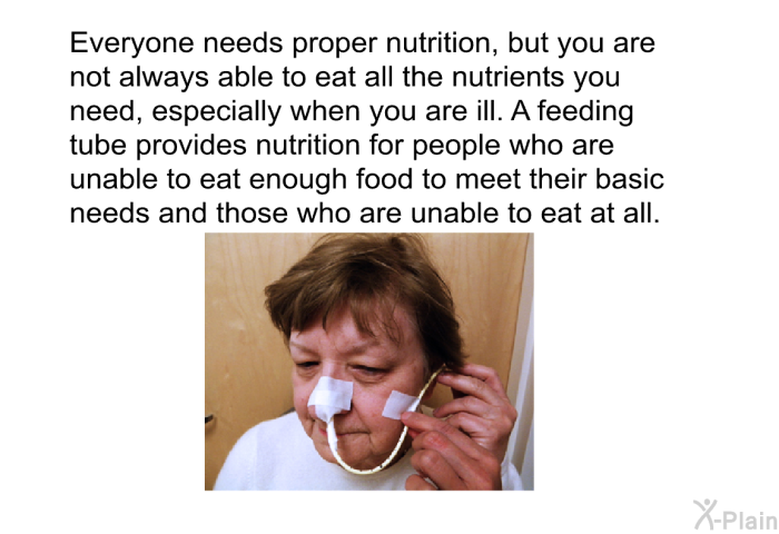Everyone needs proper nutrition, but you are not always able to eat all the nutrients you need, especially when you are ill. A feeding tube provides nutrition for people who are unable to eat enough food to meet their basic needs and those who are unable to eat at all.