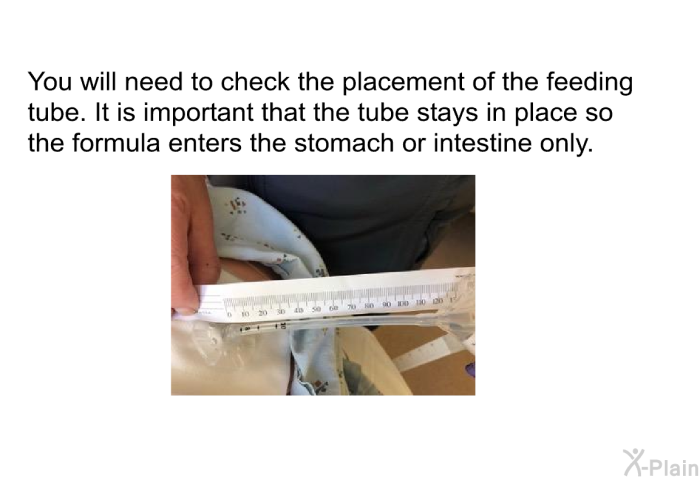 You will need to check the placement of the feeding tube. It is important that the tube stays in place so the formula enters the stomach or intestine only.