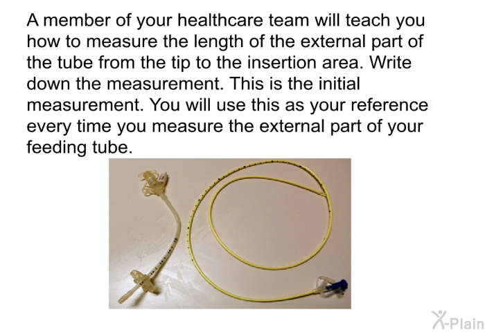 A member of your healthcare team will teach you how to measure the length of the external part of the tube from the tip to the insertion area. Write down the measurement. This is the initial measurement. You will use this as your reference every time you measure the external part of your feeding tube.