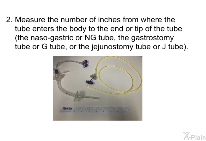 Measure the number of inches from where the tube enters the body to the end or tip of the tube (the naso-gastric or NG tube, the gastrostomy tube or G tube, or the jejunostomy tube or J tube).