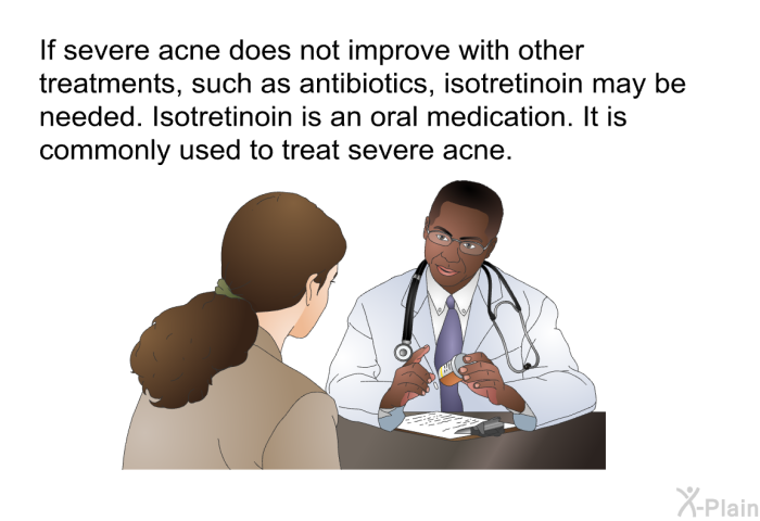 If severe acne does not improve with other treatments, such as antibiotics, isotretinoin may be needed. Isotretinoin is an oral medication. It is commonly used to treat severe acne.