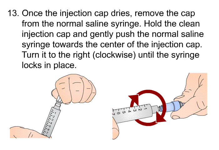 <OL START=13> Once the injection cap dries, remove the cap from the normal saline syringe. Hold the clean injection cap and gently push the normal saline syringe towards the center of the injection cap. Turn it to the right (clockwise) until the syringe locks in place.