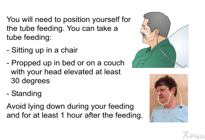 You will need to position yourself for the tube feeding. You can take a tube feeding:  Sitting up in a chair Propped up in bed or on a couch with your head elevated at least 30 degrees Standing  
 Avoid lying down during your feeding and for at least 1 hour after the feeding.