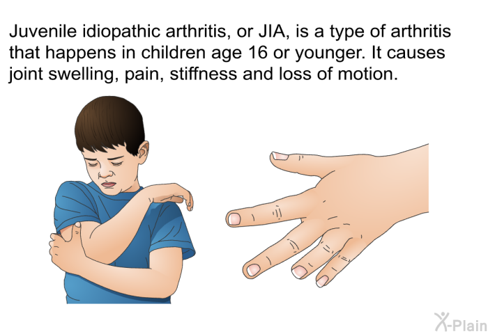 Juvenile idiopathic arthritis, or JIA, is a type of arthritis that happens in children age 16 or younger. It causes joint swelling, pain, stiffness and loss of motion.