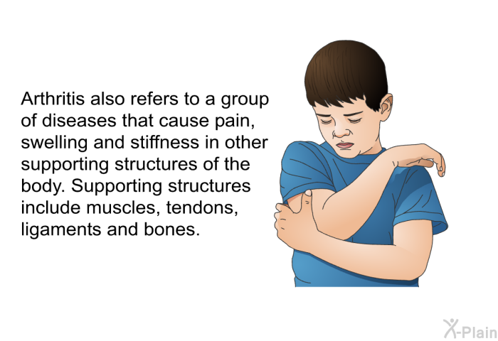 Arthritis also refers to a group of diseases that cause pain, swelling and stiffness in other supporting structures of the body. Supporting structures include muscles, tendons, ligaments and bones.