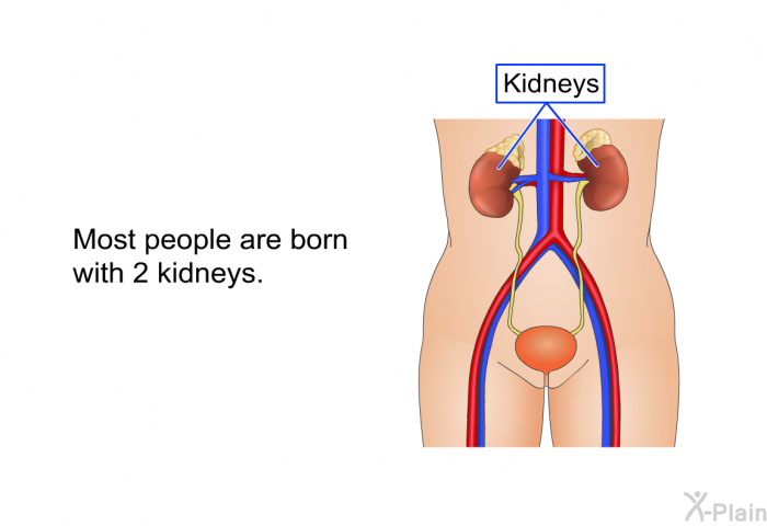 Most people are born with 2 kidneys.