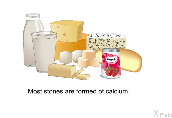 Most stones are formed of calcium.