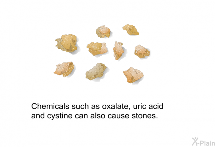 Chemicals such as oxalate, uric acid and cystine can also cause stones.