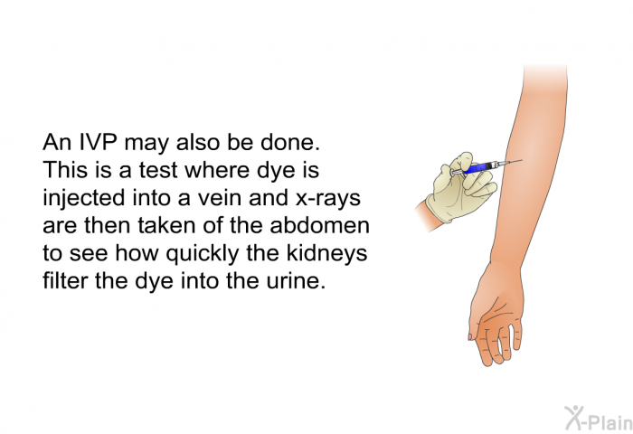 An IVP may also be done. This is a test where dye is injected into a vein and x-rays are then taken of the abdomen to see how quickly the kidneys filter the dye into the urine.