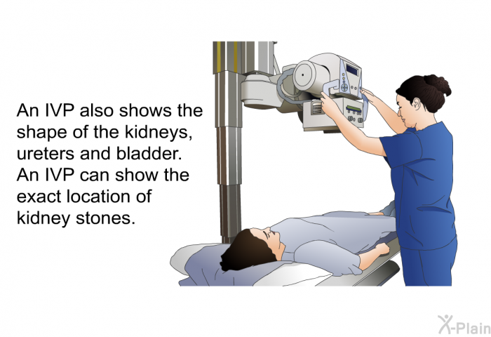 An IVP also shows the shape of the kidneys, ureters and bladder. An IVP can show the exact location of kidney stones.