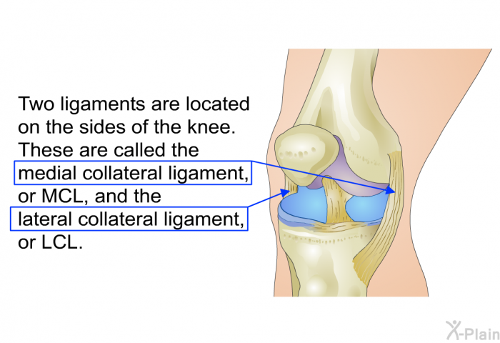 Two ligaments are located on the sides of the knee. These are called the medial collateral ligament, or MCL, and the lateral collateral ligament, or LCL.