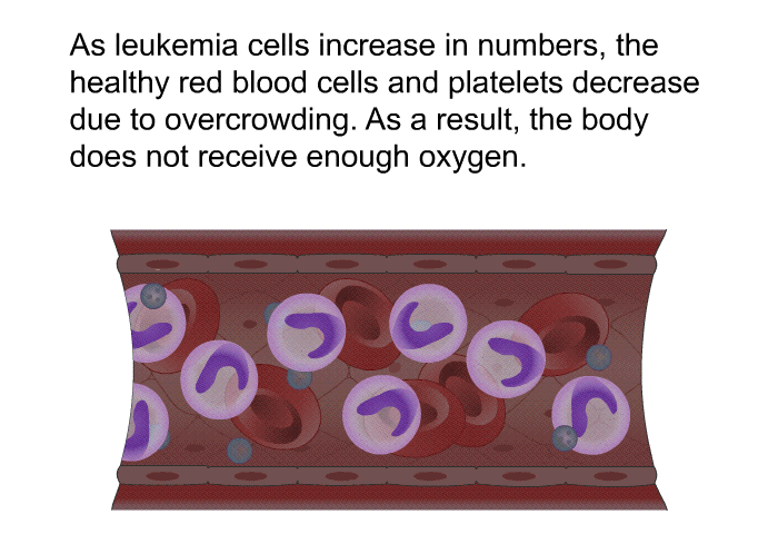 As leukemia cells increase in numbers, the healthy red blood cells and platelets decrease due to overcrowding. As a result, the body does not receive enough oxygen.