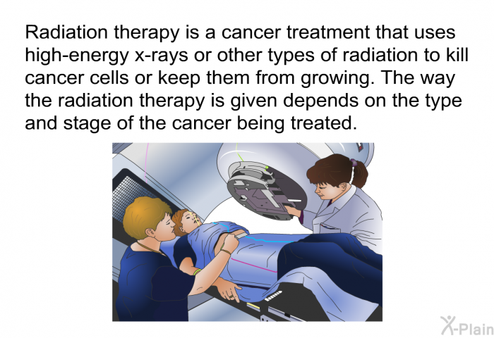 Radiation therapy is a cancer treatment that uses high-energy x-rays or other types of radiation to kill cancer cells or keep them from growing. The way the radiation therapy is given depends on the type and stage of the cancer being treated.