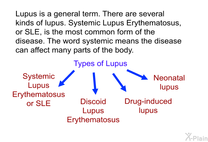 Lupus is a general term. There are several kinds of lupus. Systemic Lupus Erythematosus, or SLE, is the most common form of the disease. The word systemic means the disease can affect many parts of the body.
