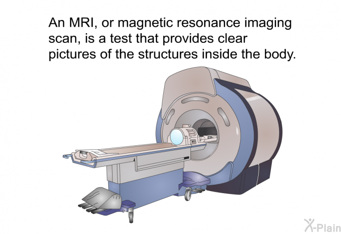 An MRI, or magnetic resonance imaging scan, is a test that provides clear pictures of the structures inside the body.