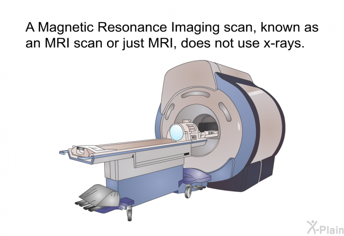 A Magnetic Resonance Imaging scan, known as an MRI scan or just MRI, does not use x-rays.