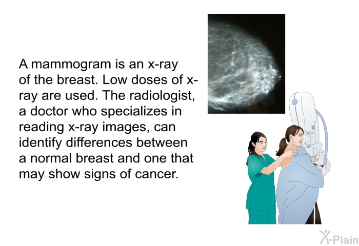 A mammogram is an x-ray of the breast. Low doses of x-ray are used. The radiologist, a doctor who specializes in reading x-ray images, can identify differences between a normal breast and one that may show signs of cancer.