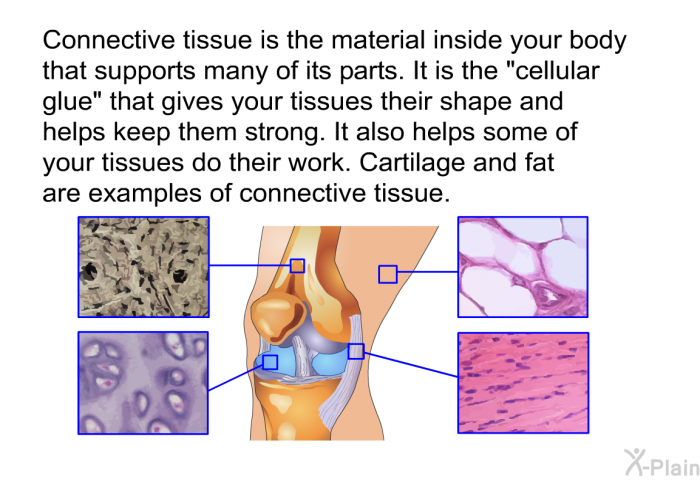 Connective tissue is the material inside your body that supports many of its parts. It is the "cellular glue" that gives your tissues their shape and helps keep them strong. It also helps some of your tissues do their work. Cartilage and fat are examples of connective tissue.
