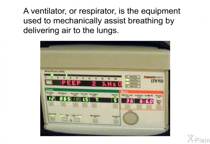A ventilator, or respirator, is the equipment used to mechanically assist breathing by delivering air to the lungs.