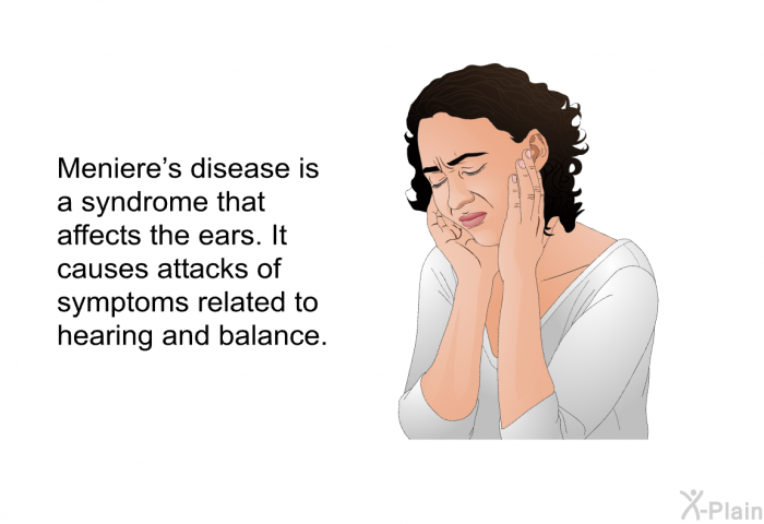 Meniere's disease is a syndrome that affects the ears. It causes attacks of symptoms related to hearing and balance.
