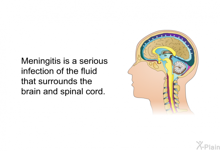 Meningitis is a serious infection of the fluid that surrounds the brain and spinal cord.