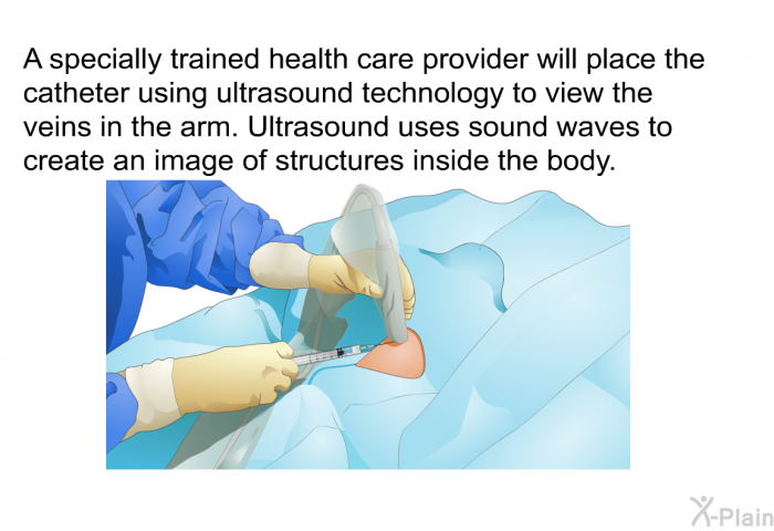 A specially trained health care provider will place the catheter using ultrasound technology to view the veins in the arm. Ultrasound uses sound waves to create an image of structures inside the body.