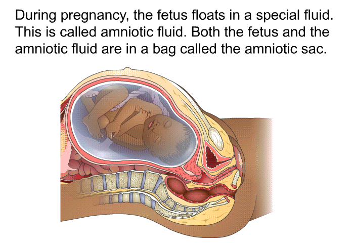 During pregnancy, the fetus floats in a special fluid. This is called amniotic fluid. Both the fetus and the amniotic fluid are in a bag called the amniotic sac.