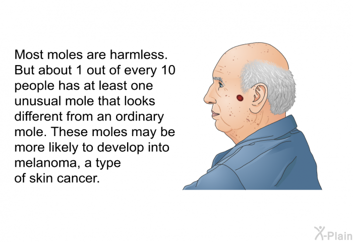 Most moles are harmless. But about 1 out of every 10 people has at least one unusual mole that looks different from an ordinary mole. These moles may be more likely to develop into melanoma, a type of skin cancer.