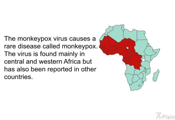 The monkeypox virus causes a rare disease called monkeypox. The virus is found mainly in central and western Africa but has also been reported in other countries.
