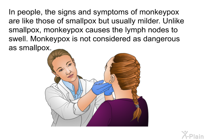 In people, the signs and symptoms of monkeypox are like those of smallpox but usually milder. Unlike smallpox, monkeypox causes the lymph nodes to swell. Monkeypox is not considered as dangerous as smallpox.
