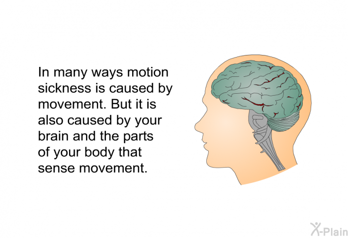 In many ways motion sickness is caused by movement. But it is also caused by your brain and the parts of your body that sense movement.