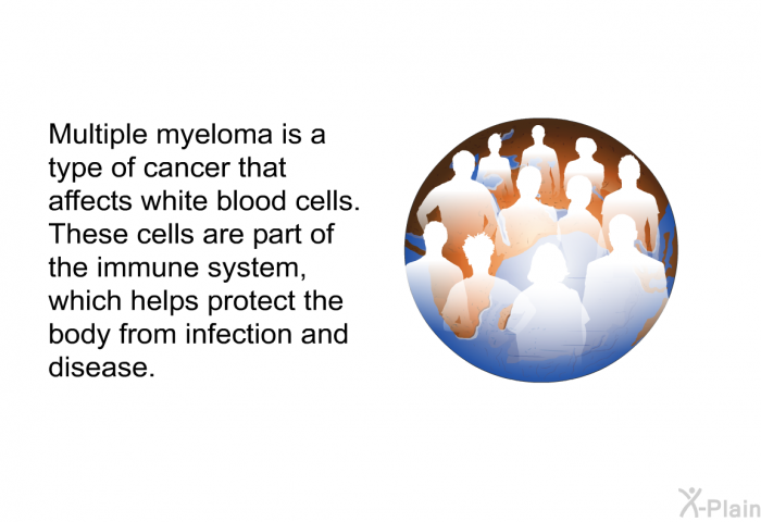 Multiple myeloma is a type of cancer that affects white blood cells. These cells are part of the immune system, which helps protect the body from infection and disease.
