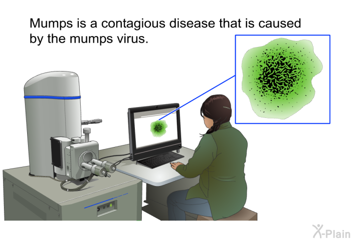 Mumps is a contagious disease that is caused by the mumps virus.
