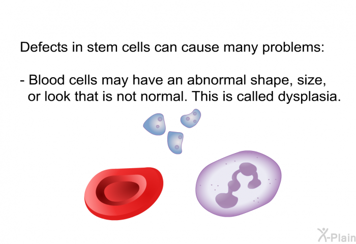 Defects in stem cells can cause many problems:  Blood cells may have an abnormal shape, size, or look that is not normal. This is called dysplasia.