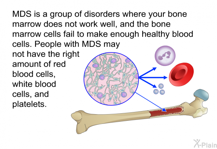 MDS is a group of disorders where your bone marrow does not work well, and the bone marrow cells fail to make enough healthy blood cells. People with MDS may not have the right amount of red blood cells, white blood cells, and platelets.