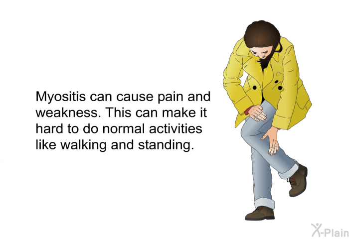 Myositis can cause pain and weakness. This can make it hard to do normal activities like walking and standing.